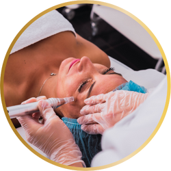 Microneedling Eye Lifting - Masajes en Málaga
