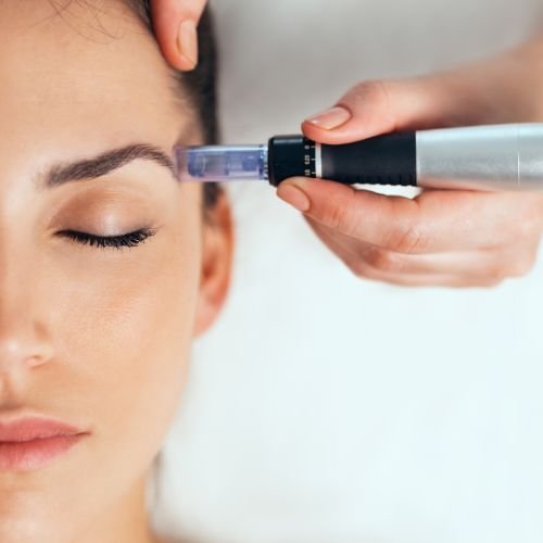 Dermapen - Tratamiento Antiedad con células madre - Masajes en Málaga