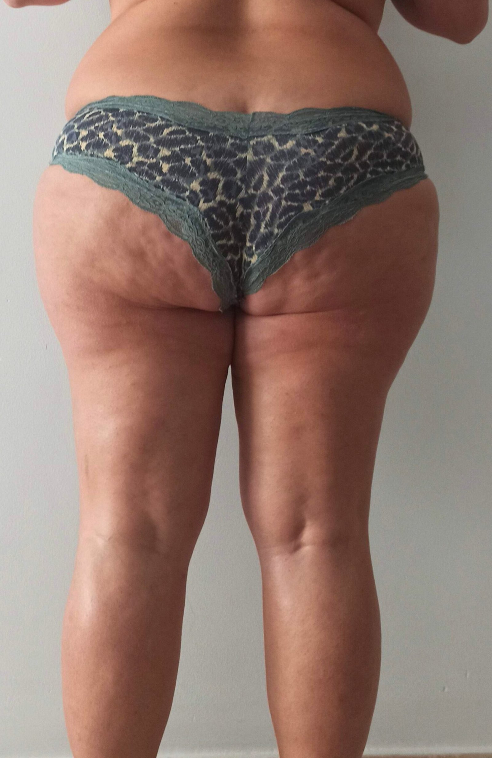 Piernas y Glúteos Después