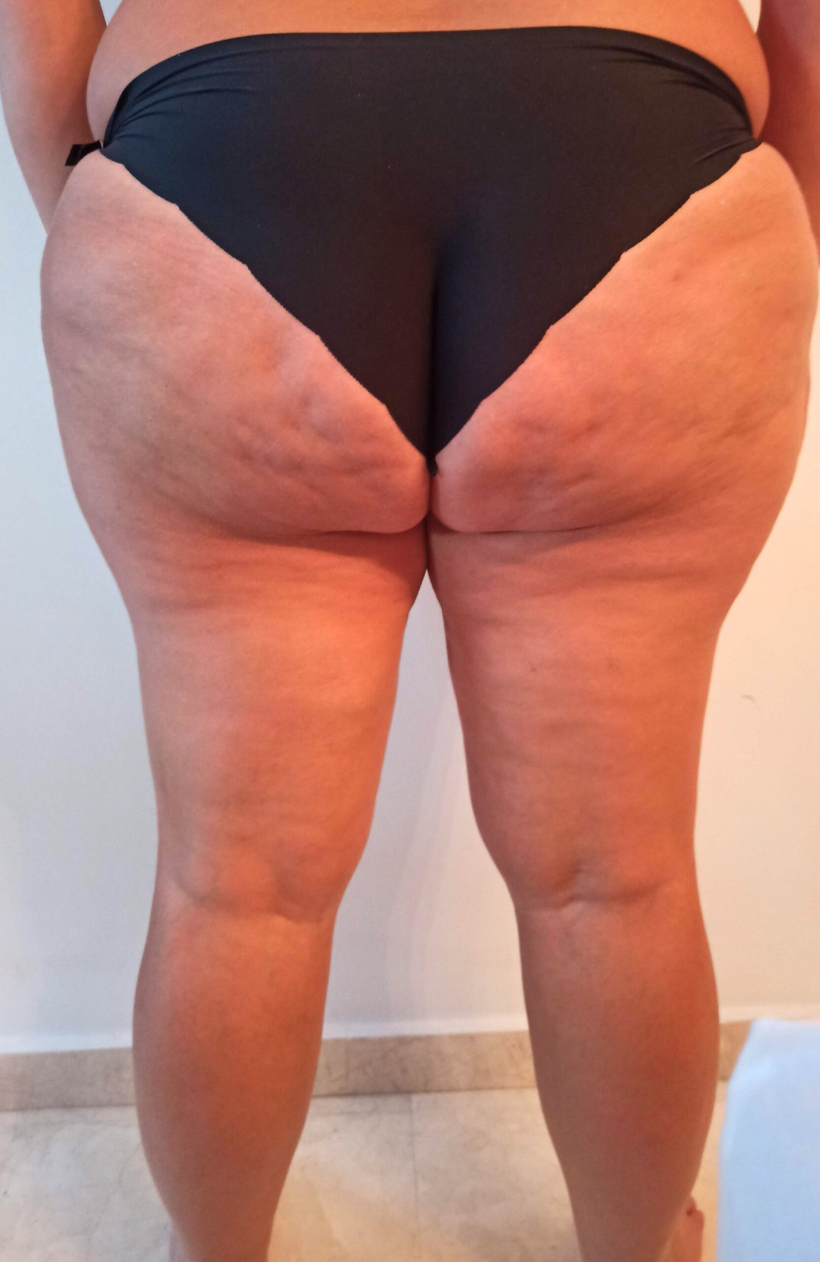 Piernas y Glúteos Antes